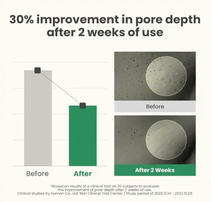 AXIS Y LHA Peel & Fill Pore Balancing Cream - Image 6